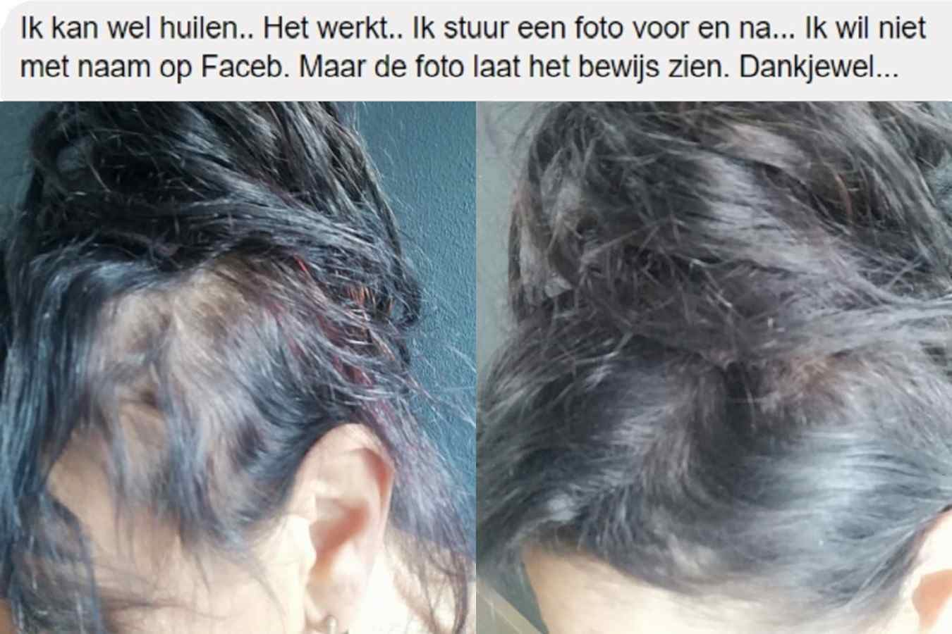 Vrouw Voor Na Imperio Haarvezels Fb